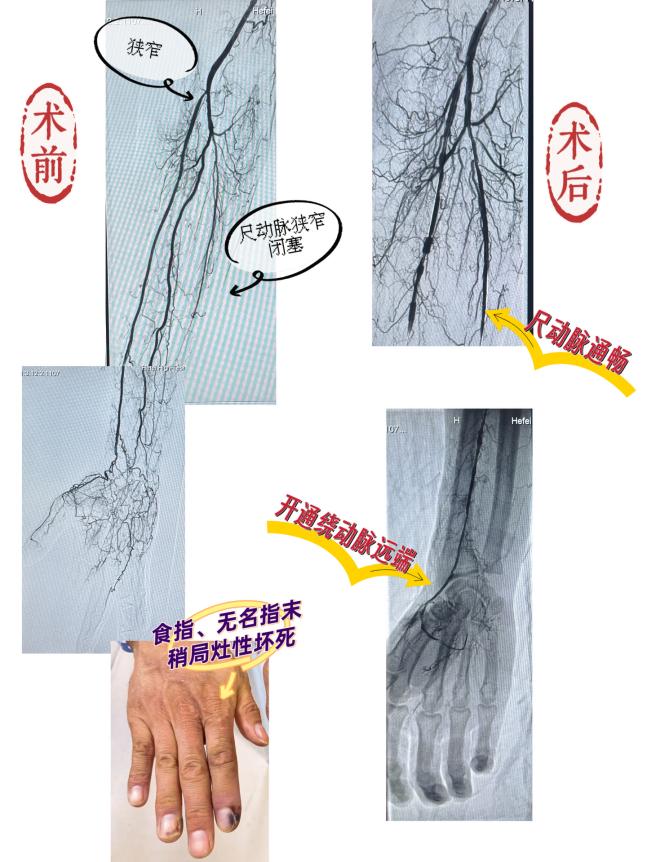 f606c9e93dff58fc44fb88c69fd8d3ac