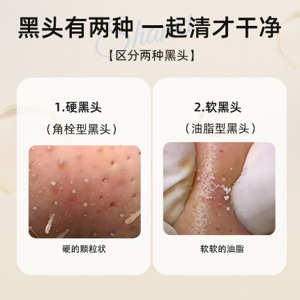 如图片无法显示，请刷新页面